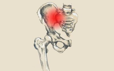 Sacroileítis y osteopatía